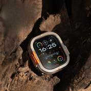 Overwatch Titanium Watch Case